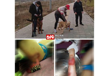 ورودی دادستانی به پرونده حمله ۲ سگ به کودکی در لواسان