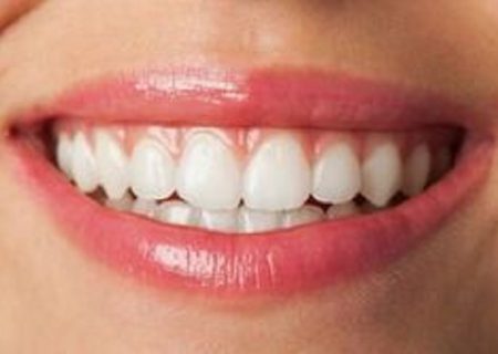 نقش دندان در ابتلا به انواع بیماری ها