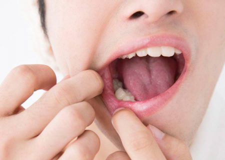 عفونتهای دهانی که سر و گردن را فرا میگیرند