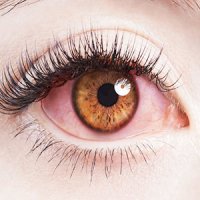 این علایم در چشمها نشانه چیست ؟