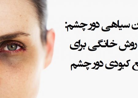درمان سیاهی دور چشم : ۲۱ روش خانگی برای رفع کبودی دور چشم