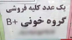 کلیه فروشی