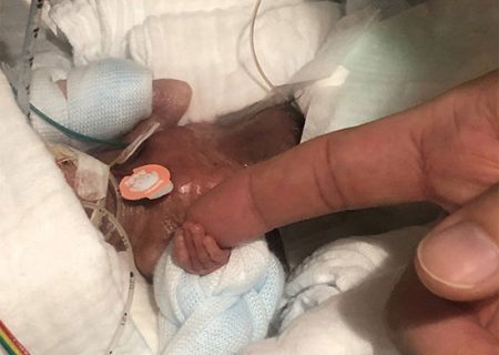 کوچکترین نوزاد نارس جهان از بیمارستان مرخص شد