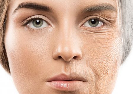 علائم پیری زودرس پوست چیست ؟
