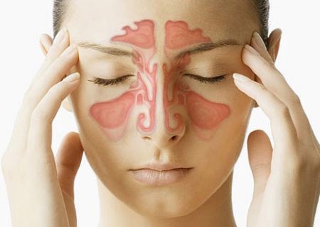 علت سردرد سینوسی چیست؟