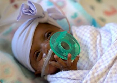 کوچک‌ترین نوزاد متولد شده جهان از بیمارستان مرخص شد