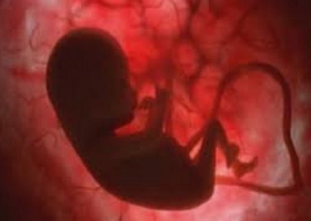 هورمون‌درمانی از سقط جنین پیشگیری می‌کند