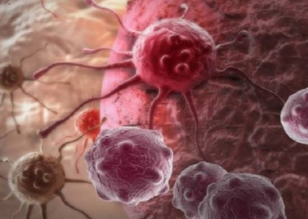 از بین بردن سلول‌های مقاوم سرطان سینه