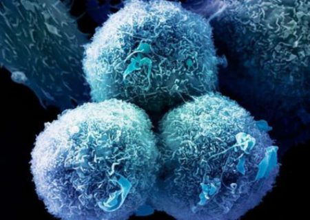 کشف داروی جدید برای از بین بردن تومورهای سرطانی