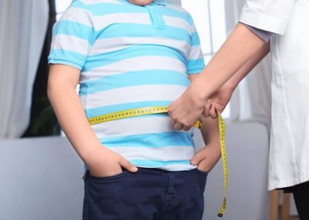  علت مهم چاقی در کودکان