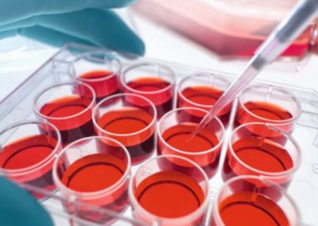 طرحی برای درمان سرطان به کمک سلول‌های خون بند ناف
