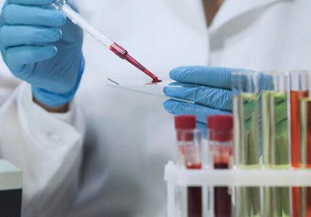 ساخت یک واکسن جدید برای ایدز