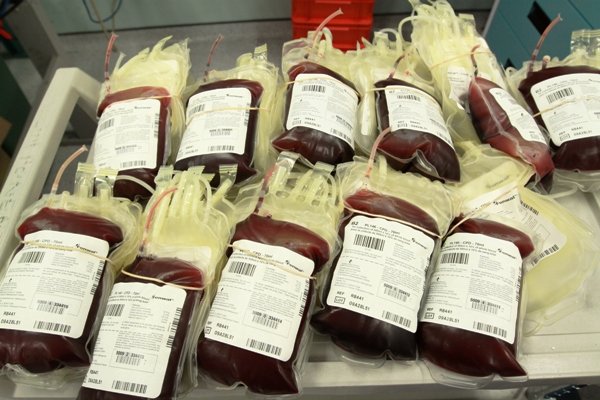 افزایش احتمال لختگی خون در این گروه های خونی