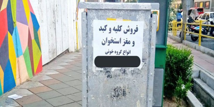 فروش کلیه
