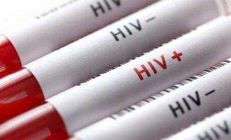 برای انجام “تست رایگان HIV” به کجا مراجعه کنیم؟
