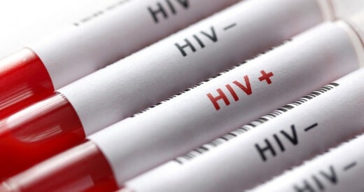برای انجام “تست رایگان HIV” به کجا مراجعه کنیم؟