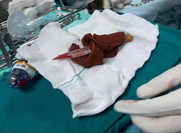 چاقو زن کارتن خواب در حمله به پرستار بیمارستان تجریش 
