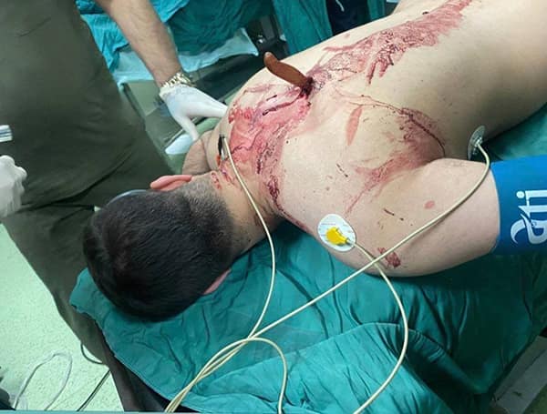 حمله به پرستار بیمارستان تجریش با ضربات چاقو