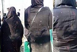 اسیدپاشی به زنان